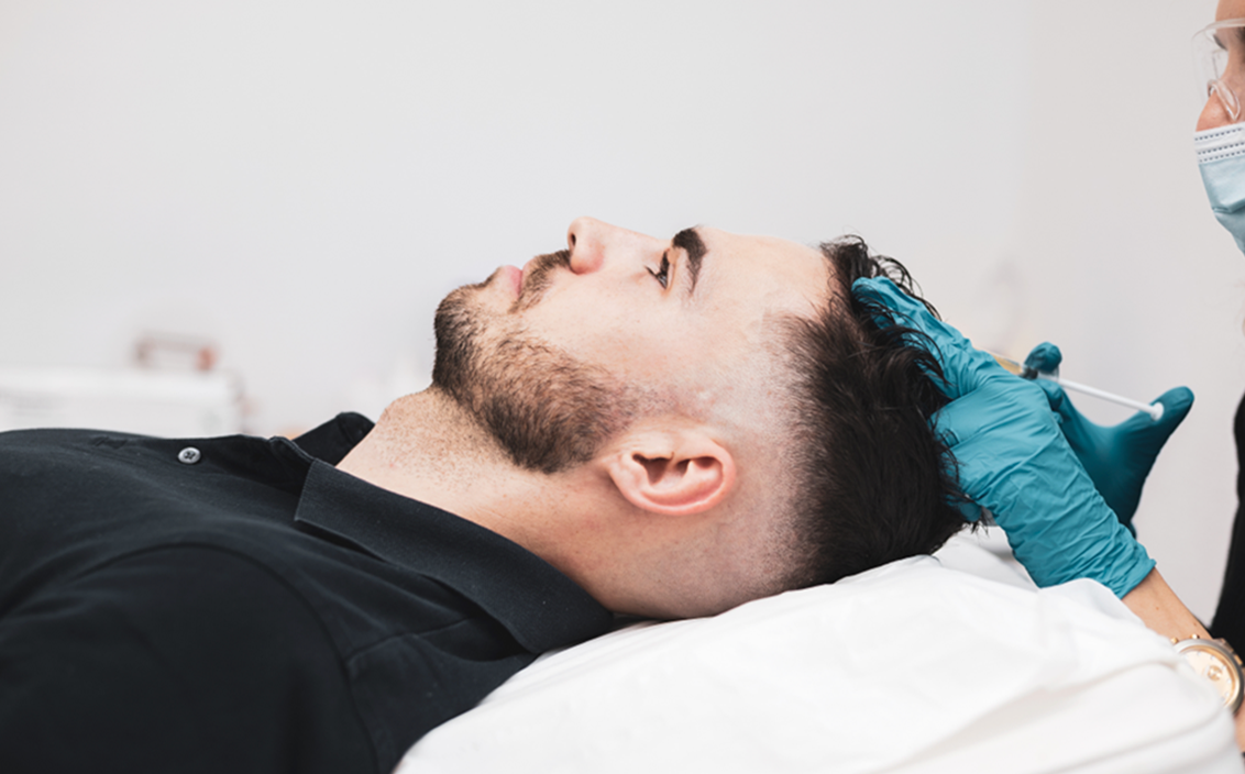 hair-restoration