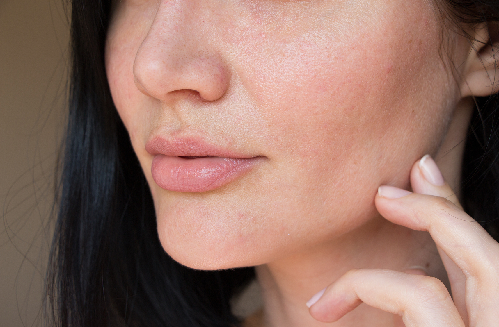 FACIAL FLUSHING CONDITION_BODYTEXT (1)